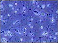 Sperm